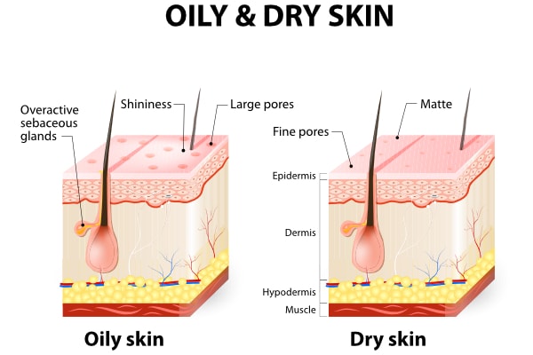 Oily vs Dry Skin