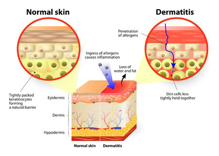 Sensitive-Skin diagram