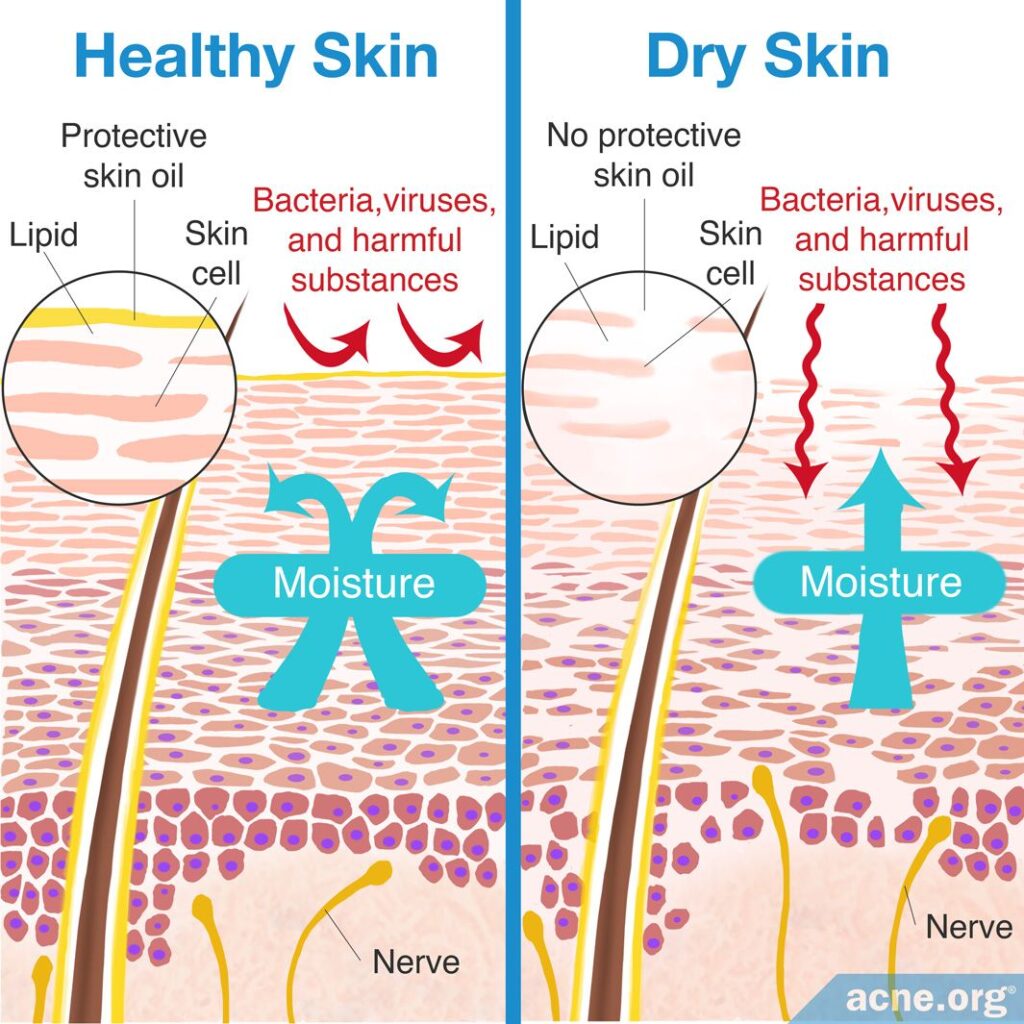 dry skin vs normal skin